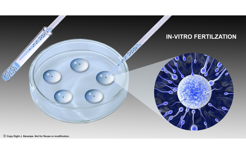 體外受精技術(shù)平臺